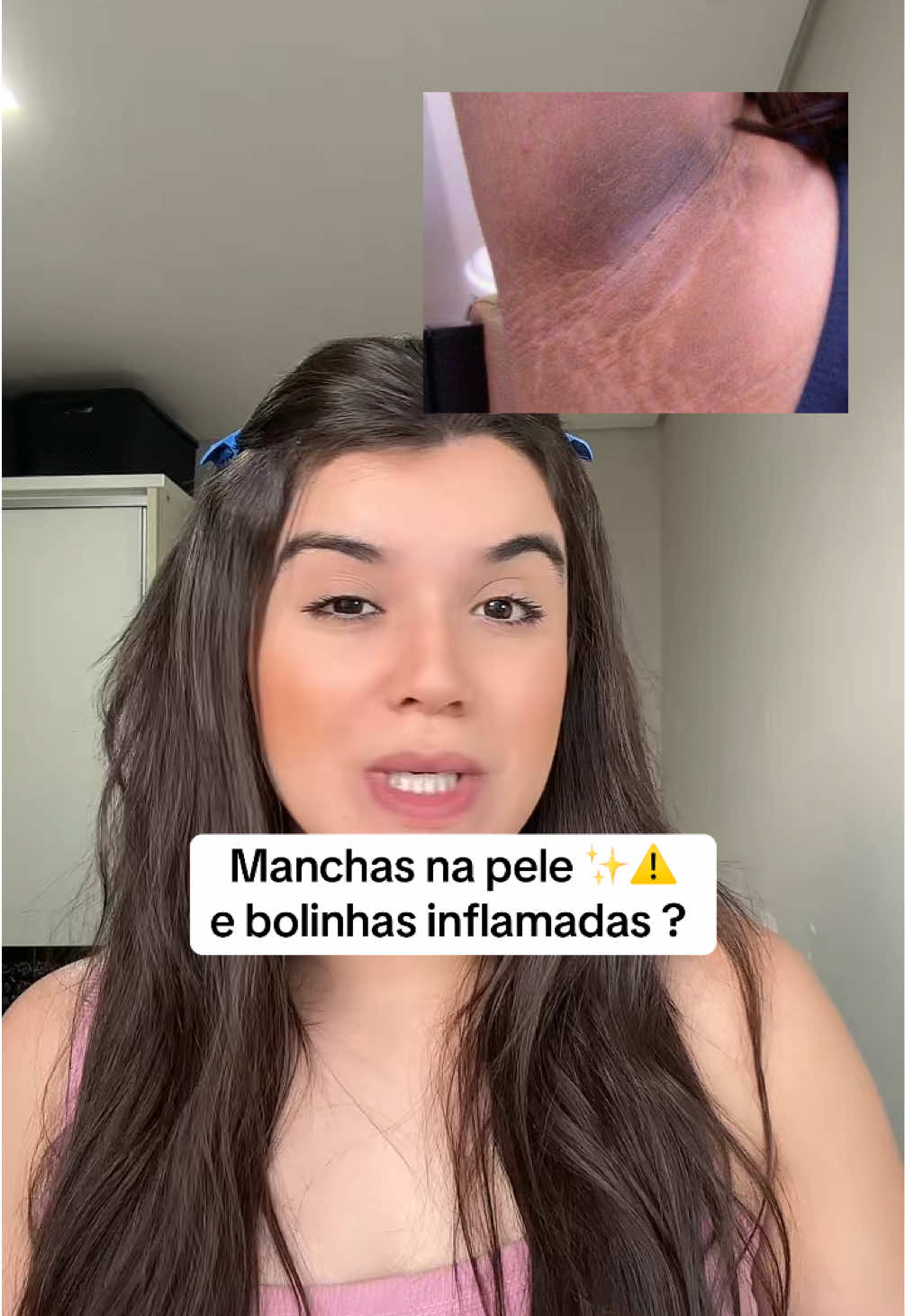 Capa do vídeo TikTok